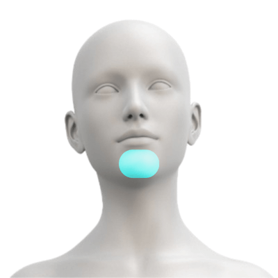 Laser Hair Removal for Women's Chin